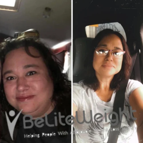 Weight Loss Surgery Before And After Davina G - 6 Month Update*
